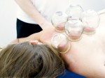 Cupping Therapy