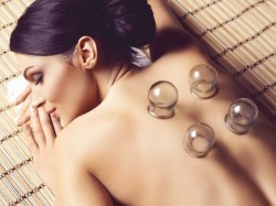 Cupping Therapy from Rose Dennigan Holistic Therapies, Westport, County Mayo, Ireland